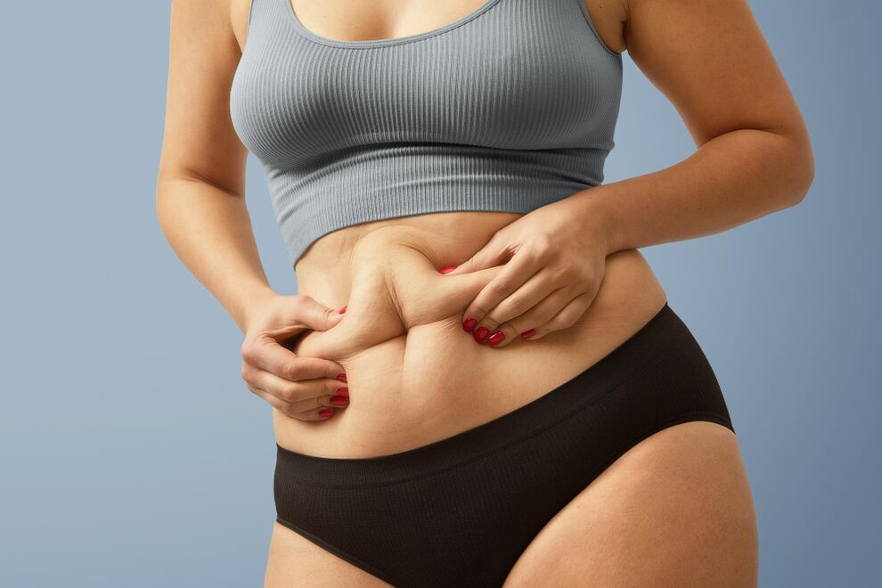 Stomach fat deposits